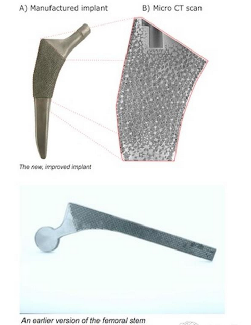 MicGill大學(xué)推出接近天然骨的多孔3D打印骨骼植入物國外新聞3D虎